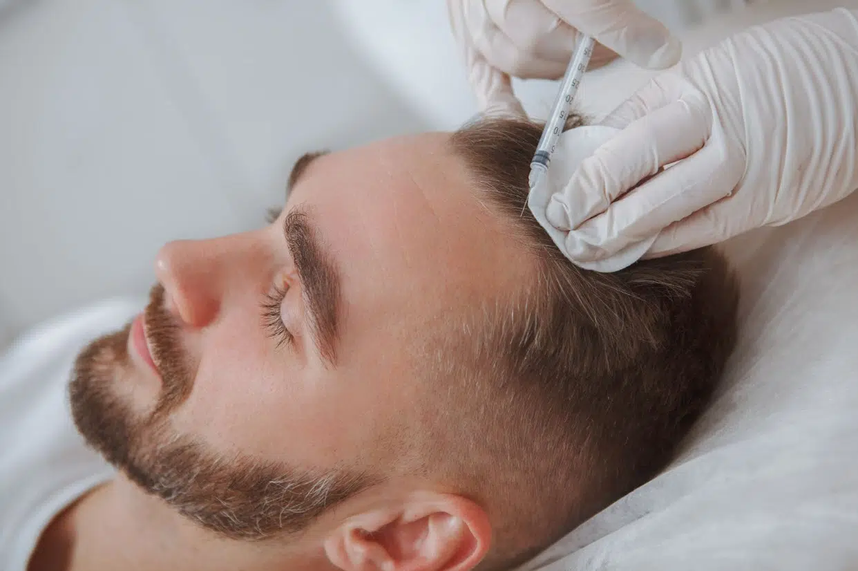 PRP-Hair-Treatment-Results.jpg