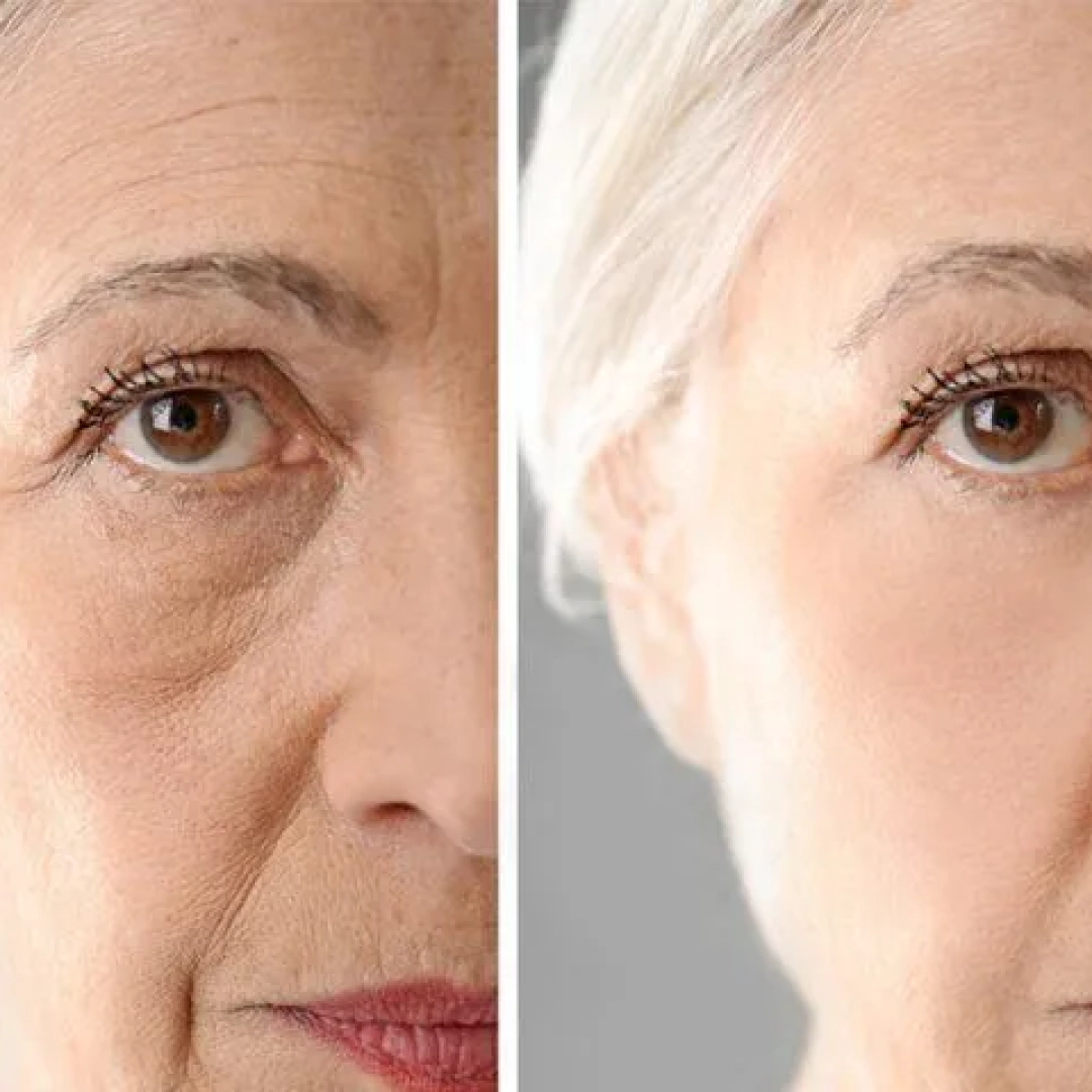 anti_aging