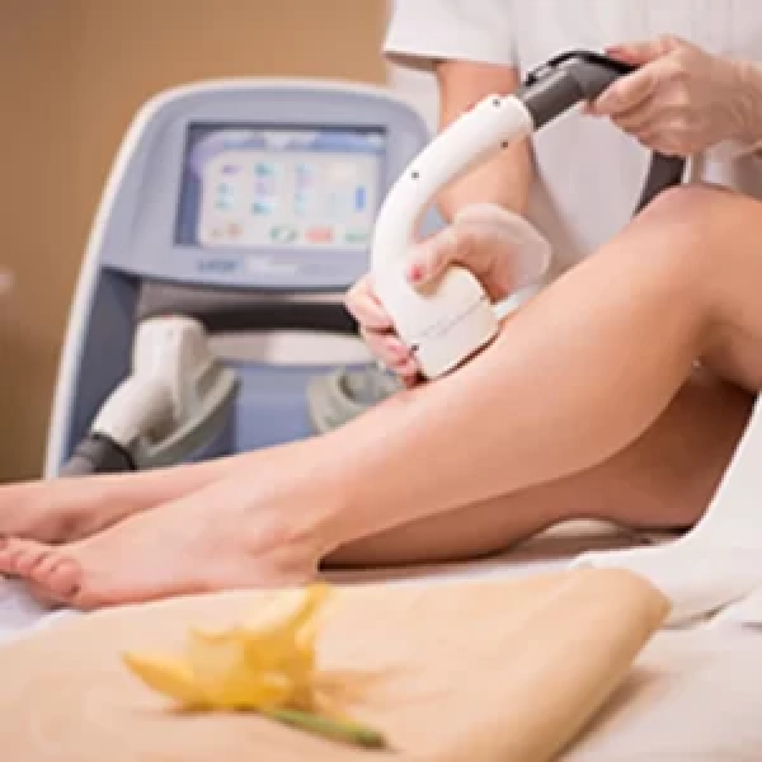 laser-hair-removal-300x300