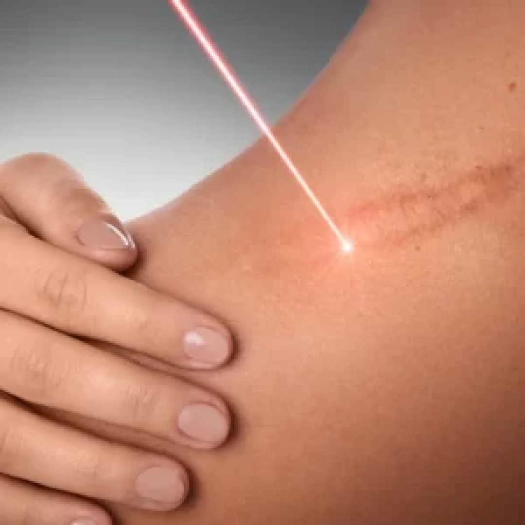 mark-removal-300x300