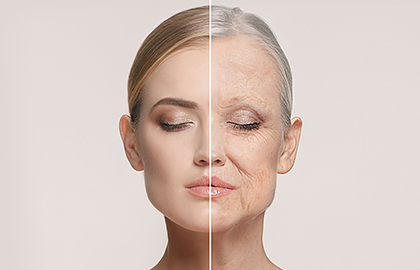 platelet-rich-plasma-vampire-facial