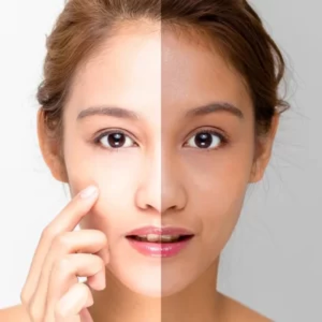 skin-whitening-300x300 (1)